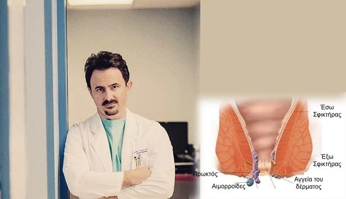 Αιμορροΐδες ΤΕΛΟΣ: Παρελθόν σε μισή ώρα με υπέρηχο