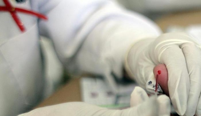 Ξεκινά η μεγαλύτερη δοκιμή νέου εμβολίου κατά του AIDS