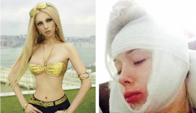 Θύμα ξυλοδαρμού από αγνώστους η... Barbie!