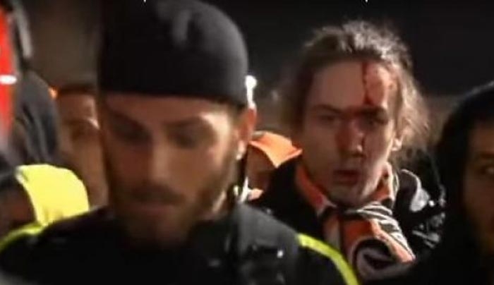 Σοβαρά επεισόδια στο Μπιλμπάο – ΑΠΟΕΛ! Άγριο ξύλο με τραυματίες [βίντεο]