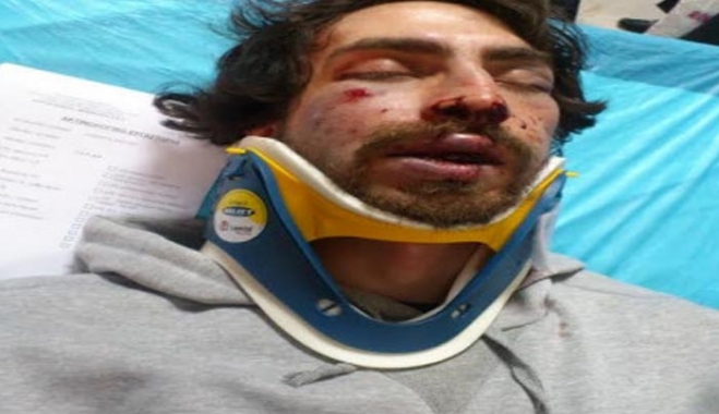 Τάγμα Χρυσαυγιτών ξυλοκόπησε μέχρι λιποθυμίας 24χρονο φοιτητή - Δεν μπορούσε ούτε να καταθέσει - Σοκάρουν οι φωτογραφίες