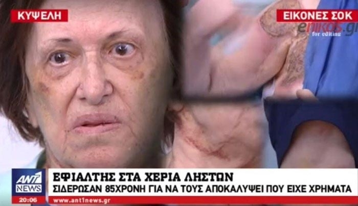 Η συγκλονιστική μαρτυρία της 85χρονης που έκαψαν με σίδερο - ΒΙΝΤΕΟ
