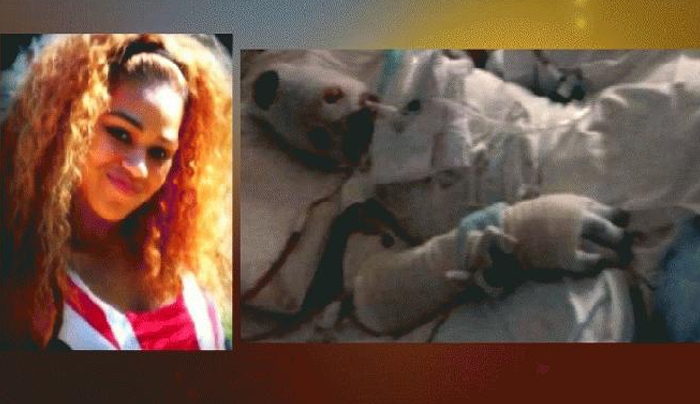 Απίστευτο: 19χρονη καίγεται ζωντανή μετά από κατάποση αντιβιοτικού (Photo &amp; Video)