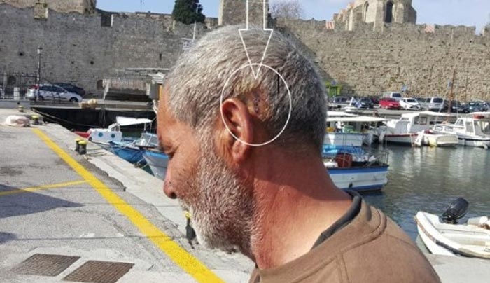 Ρόδος: Τον έσπασαν στο ξύλο επειδή πήγε να ψαρέψει κοντά σε καταυλισμό τσιγγάνων