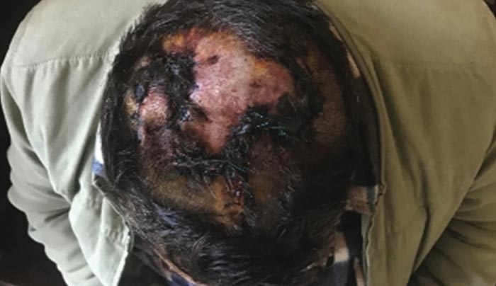Συνελήφθη 42χρονη διωκόμενη, ως ηθικός αυτουργός, στην υπόθεση ληστείας του 50χρονου